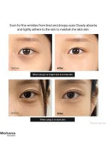 کرم دور چشم کلسیم دکتر ملاکسین مدل Calcium Dark Spot - Image 6