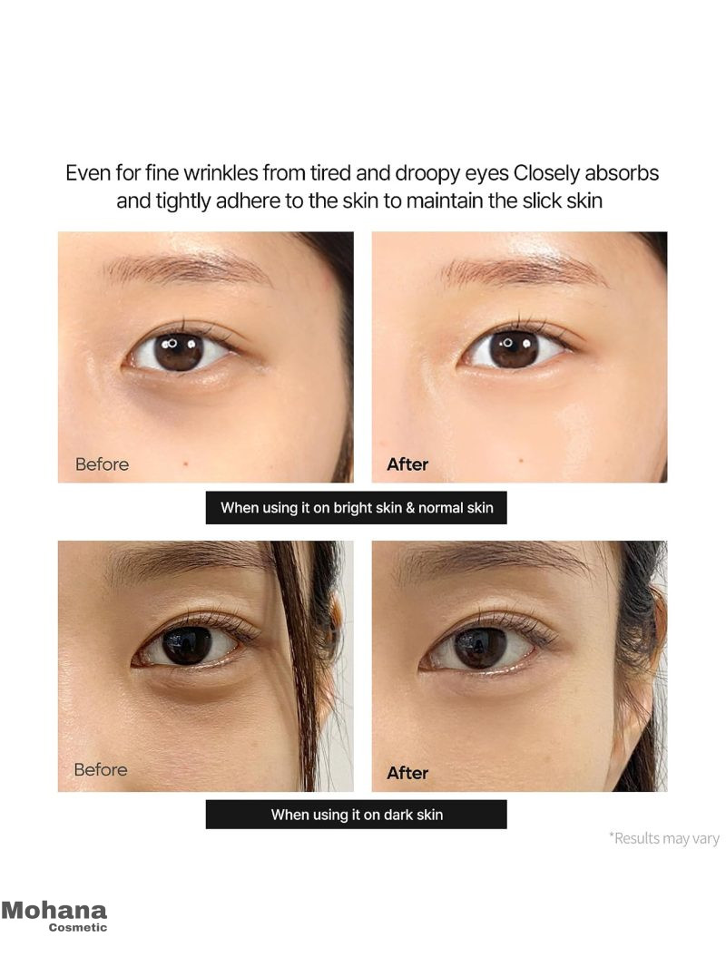 کرم دور چشم کلسیم دکتر ملاکسین مدل Calcium Dark Spot - Image 6